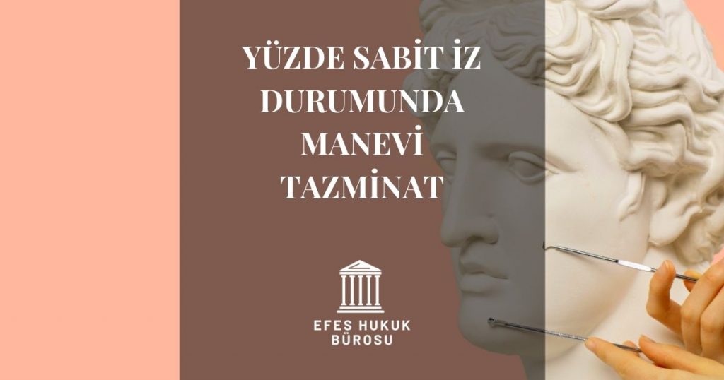 Yüzde Sabit İz Manevi Tazminat